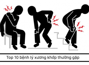 Top 10 bệnh lý xương khớp thường gặp